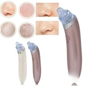 EXTRACTOR DE PUNTOS NEGROS
